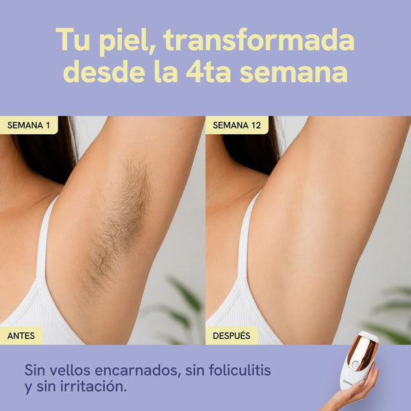 Lummia IPL Pro